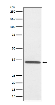 Fibrillarin Rabbit mAb Antibody