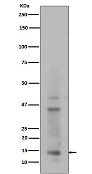 Histone H3 (mono+di+tri methyl K14) Rabbit mAb Antibody