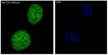 JNK1/2/3 Rabbit mAb Antibody