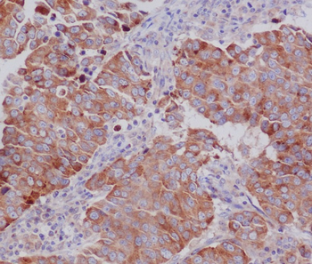 PUMA Rabbit mAb Antibody