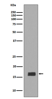alpha + beta Synuclein Rabbit Monoclonal Antibody