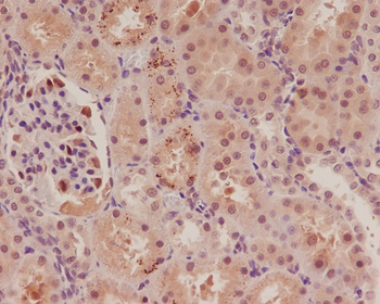p57 Kip2 Rabbit Monoclonal Antibody