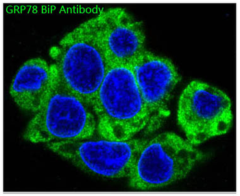 GRP78 BiP Rabbit Monoclonal Antibody