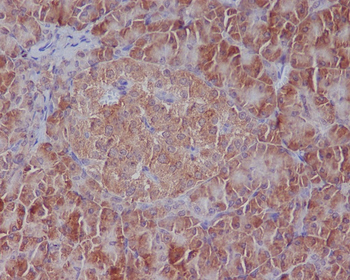 GRP78 BiP Rabbit Monoclonal Antibody