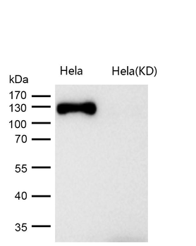 GM130 Rabbit mAb [KD Validated] Antibody