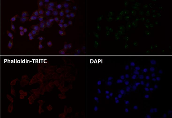 GM130 Rabbit mAb [KD Validated] Antibody