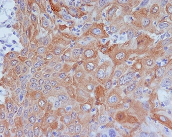 GM130 Rabbit mAb [KD Validated] Antibody