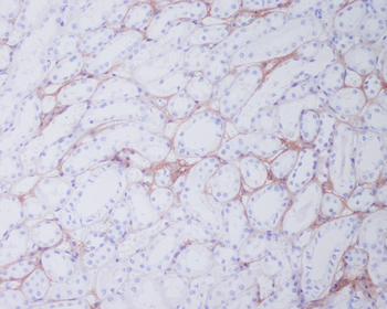 Collagen I Rabbit mAb Antibody