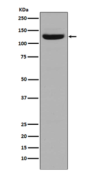 Collagen I Rabbit mAb Antibody