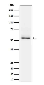 Tau (Phospho-Ser404) Rabbit mAb Antibody