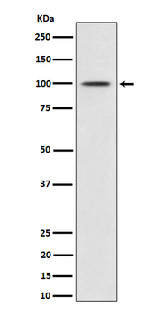 MDM2 (Phospho-Ser166) Rabbit mAb Antibody