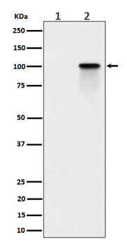 Nucleolin (Phospho-Thr84) Rabbit mAb Antibody