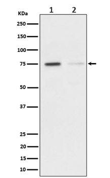 TAK1(Phospho-Ser439) Rabbit mAb Antibody