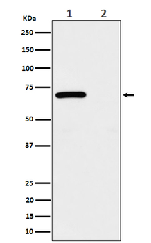 Chk2 (Phospho-Thr68) Rabbit mAb Antibody