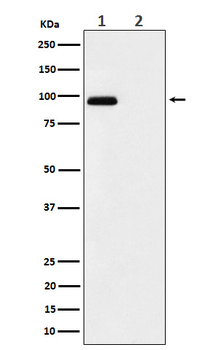 FGFR3 (Phospho-Tyr724) Rabbit mAb Antibody