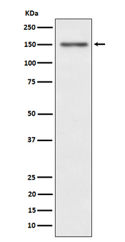 Met (c-Met) (Phospho-Tyr1349) Rabbit mAb Antibody