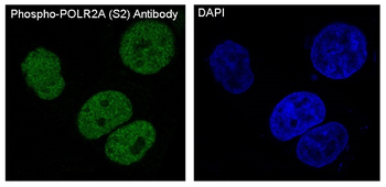 POLR2A (Phospho-Ser2) Rabbit mAb Antibody