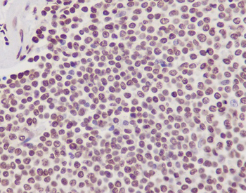 POLR2A (Phospho-Ser2) Rabbit mAb Antibody