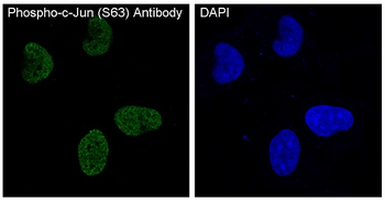 c-Jun (Phospho-Ser63) Rabbit mAb Antibody