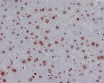 Histone H2A.X (Phospho-Ser139) Rabbit mAb Antibody