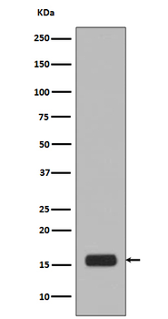 Histone H2A.X (Phospho-Ser139) Rabbit mAb Antibody