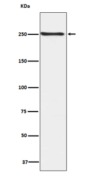 mTOR (Phospho-Ser2448) Rabbit mAb Antibody