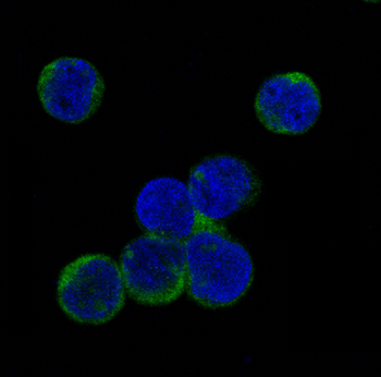 JAK2 (Phospho-Tyr1007/Tyr1008) Rabbit mAb Antibody