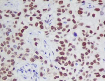 JAK2 (Phospho-Tyr1007/Tyr1008) Rabbit mAb Antibody