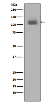 JAK2 (Phospho-Tyr1007/Tyr1008) Rabbit mAb Antibody