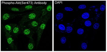 Akt(Phospho-Ser473) Rabbit mAb Antibody