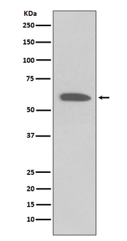 Akt(Phospho-Ser473) Rabbit mAb Antibody