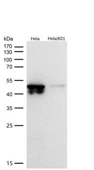 GSK3β(Phospho-Ser9) Rabbit mAb [KD Validated] Antibody