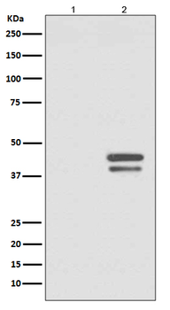 JunD (Phospho-Ser255) Rabbit mAb Antibody