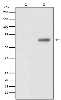 AKT1 (Phospho-Thr450) Rabbit mAb Antibody