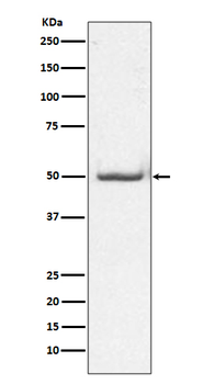 c-Jun (Phospho-Thr91) Rabbit mAb Antibody
