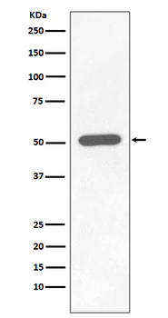 Chk1 (Phospho-Ser296) Rabbit mAb Antibody