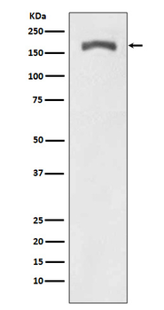 PDGF Receptor beta (Phospho-Tyr740) Rabbit mAb Antibody