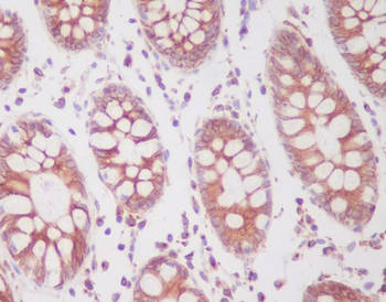 SIRT1 (Phospho-Ser47) Rabbit mAb Antibody