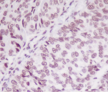 SMC1 (Phospho-Ser957) Rabbit mAb Antibody