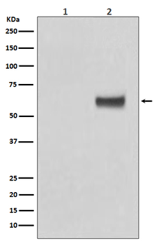 ER alpha (Phospho-Ser118) Rabbit mAb Antibody