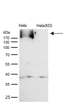 EGFR (Phospho-Tyr1173) Rabbit mAb [KD Validated] Antibody