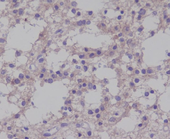 TrkB (Phospho-Tyr817) Rabbit mAb Antibody