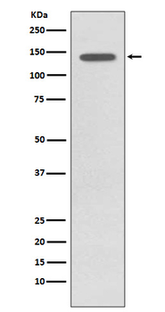 TrkB (Phospho-Tyr817) Rabbit mAb Antibody