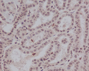 Stat5 (Phospho-Tyr694) Rabbit mAb Antibody
