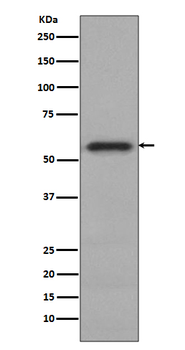 c-Myc (Phospho-Ser62) Rabbit mAb Antibody