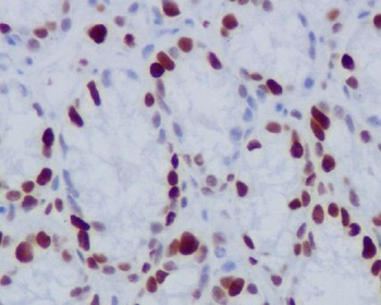 Histone H1.4 (Phospho-Thr17) Rabbit mAb Antibody