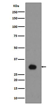 Histone H1.4 (Phospho-Thr17) Rabbit mAb Antibody