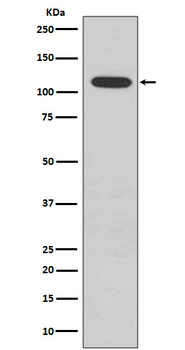 Retinoblastoma (Phospho-Ser807) Rabbit mAb Antibody