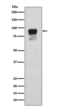 Glycogen synthase 1 (Phospho-Ser641) Rabbit mAb [KD Validated] Antibody