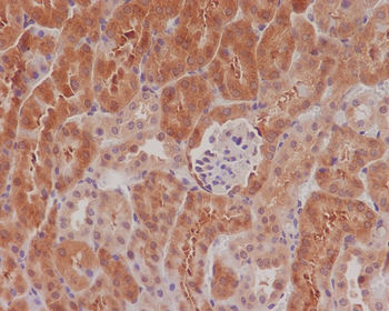 eIF4E (Phospho-Ser209) Rabbit mAb Antibody
